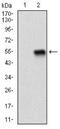Zinc Finger E-Box Binding Homeobox 1 antibody, NBP2-37329, Novus Biologicals, Western Blot image 