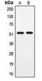 Periphilin 1 antibody, orb215180, Biorbyt, Western Blot image 