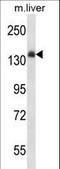 Insulin Receptor antibody, LS-C164424, Lifespan Biosciences, Western Blot image 