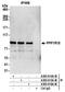 Protein Phosphatase 1 Regulatory Subunit 18 antibody, A305-614A-M, Bethyl Labs, Immunoprecipitation image 