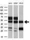 Vesicle Amine Transport 1 Like antibody, M18138, Boster Biological Technology, Western Blot image 