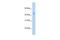Protein Arginine Methyltransferase 8 antibody, GTX47431, GeneTex, Western Blot image 