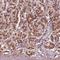 Protein transport protein Sec23B antibody, HPA069974, Atlas Antibodies, Immunohistochemistry paraffin image 