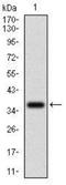 Interleukin 3 Receptor Subunit Alpha antibody, NBP2-37354, Novus Biologicals, Western Blot image 