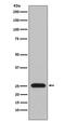 Immunoglobulin Lambda Variable 1-51 antibody, M13347, Boster Biological Technology, Western Blot image 