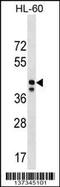 Mitochondrial Ribosomal Protein S31 antibody, 60-091, ProSci, Western Blot image 
