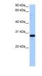 Transcription Elongation Factor A N-Terminal And Central Domain Containing 2 antibody, NBP1-79423, Novus Biologicals, Western Blot image 