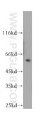 Tubulin Folding Cofactor E antibody, 12021-1-AP, Proteintech Group, Western Blot image 