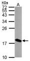 LSM4 Homolog, U6 Small Nuclear RNA And MRNA Degradation Associated antibody, NBP2-17182, Novus Biologicals, Western Blot image 