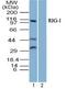 DExD/H-Box Helicase 58 antibody, PA5-23497, Invitrogen Antibodies, Western Blot image 