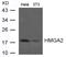 High Mobility Group AT-Hook 2 antibody, A00436, Boster Biological Technology, Western Blot image 