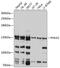 Phosphorylase Kinase Regulatory Subunit Alpha 2 antibody, 23-888, ProSci, Western Blot image 