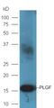 Placental Growth Factor antibody, GTX60318, GeneTex, Western Blot image 