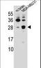 Cerebellin 2 Precursor antibody, LS-C168353, Lifespan Biosciences, Western Blot image 