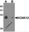 Potassium Two Pore Domain Channel Subfamily K Member 12 antibody, 6425, ProSci, Western Blot image 