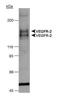 Fms Related Tyrosine Kinase 1 antibody, NB100-527, Novus Biologicals, Western Blot image 