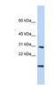 RNA Polymerase II Subunit K antibody, NBP1-55166, Novus Biologicals, Western Blot image 