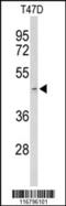 ACR antibody, 63-772, ProSci, Western Blot image 