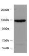 SLIT-ROBO Rho GTPase Activating Protein 2 antibody, GTX88045, GeneTex, Western Blot image 