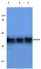 Alpha-1,4-N-Acetylglucosaminyltransferase antibody, PA5-75387, Invitrogen Antibodies, Western Blot image 