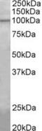 Cytosolic carboxypeptidase-like protein 5 antibody, NBP2-27482, Novus Biologicals, Western Blot image 