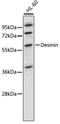 Desmin antibody, STJ23368, St John