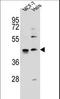 Zinc Finger Protein 384 antibody, LS-C160864, Lifespan Biosciences, Western Blot image 