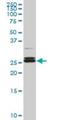 Platelet Activating Factor Acetylhydrolase 1b Catalytic Subunit 3 antibody, H00005050-M08, Novus Biologicals, Western Blot image 