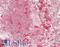 Alanyl-TRNA Synthetase antibody, LS-B14162, Lifespan Biosciences, Immunohistochemistry paraffin image 