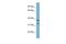 Ral GEF With PH Domain And SH3 Binding Motif 2 antibody, GTX44981, GeneTex, Western Blot image 