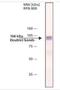 Adaptor Related Protein Complex 1 Subunit Gamma 1 antibody, NBP2-22155, Novus Biologicals, Western Blot image 