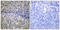 Neutrophil Cytosolic Factor 1 antibody, LS-C118008, Lifespan Biosciences, Immunohistochemistry frozen image 