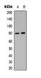 G Protein-Coupled Receptor Kinase 2 antibody, orb393199, Biorbyt, Western Blot image 