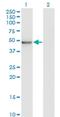 Zinc Finger MYND-Type Containing 10 antibody, H00051364-M05, Novus Biologicals, Western Blot image 