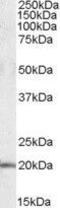 U2 Small Nuclear RNA Auxiliary Factor 1 Like 4 antibody, GTX88491, GeneTex, Western Blot image 