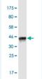 Intersectin 1 antibody, H00006453-M02-100ug, Novus Biologicals, Western Blot image 