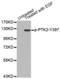 Protein Tyrosine Kinase 2 antibody, abx000484, Abbexa, Western Blot image 