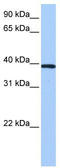 Zinc Finger Protein 618 antibody, TA339786, Origene, Western Blot image 