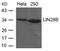Lin-28 Homolog B antibody, GTX50820, GeneTex, Western Blot image 