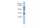 Tubulin Tyrosine Ligase antibody, A06710, Boster Biological Technology, Western Blot image 