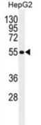 Major Facilitator Superfamily Domain Containing 10 antibody, abx026220, Abbexa, Western Blot image 