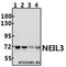 Nei Like DNA Glycosylase 3 antibody, A05497-2, Boster Biological Technology, Western Blot image 