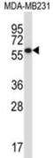 Protein Phosphatase 2 Regulatory Subunit B'Gamma antibody, abx027753, Abbexa, Western Blot image 