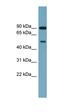 Phosphatidylinositol 4-Kinase Type 2 Beta antibody, orb326161, Biorbyt, Western Blot image 