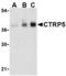 C1q And TNF Related 5 antibody, TA306236, Origene, Western Blot image 
