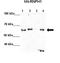 Heterogeneous Nuclear Ribonucleoprotein H1 antibody, orb326259, Biorbyt, Immunohistochemistry paraffin image 