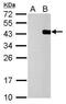 Paired Like Homeodomain 2 antibody, GTX127973, GeneTex, Western Blot image 