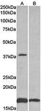 Beta-1,3-Glucuronyltransferase 1 antibody, orb79342, Biorbyt, Western Blot image 