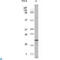 Eukaryotic Translation Initiation Factor 4E Binding Protein 1 antibody, LS-C812386, Lifespan Biosciences, Western Blot image 