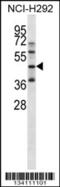 Kruppel Like Factor 1 antibody, 57-769, ProSci, Western Blot image 